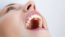 MYOSPOTS Blåbær (100 stk) thumbnail